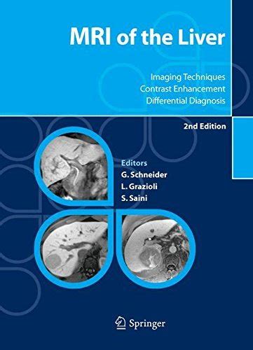 MRI of the Liver: Imaging Techniques, Contrast Enhancement, Differential Diagnosis eBook ...