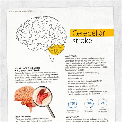 What is a Cerebellar Stroke? – Adult and pediatric printable resources ...