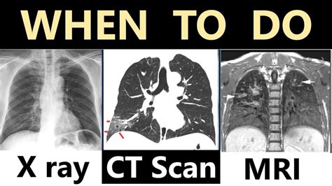 Choosing The Best Test For You X Ray CT Scan Or MRI Dr Education 26688 | Hot Sex Picture