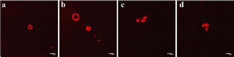 Fluorescent microscopic images of the compound 33 with dye 56. Final... | Download Scientific ...