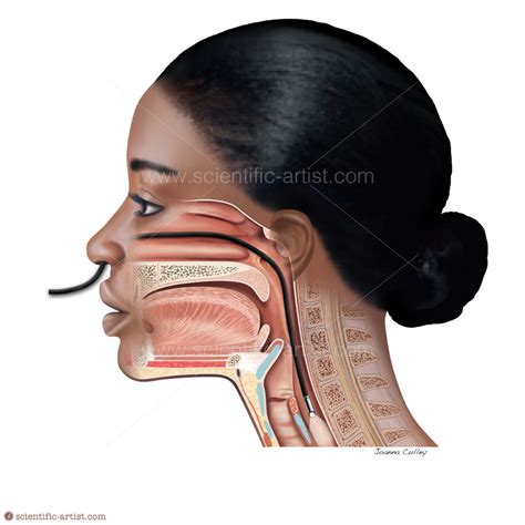 Transnasal Endoscopy | | Scientific-Artist.com | Scientific Artist Joanna Culley providing Art ...