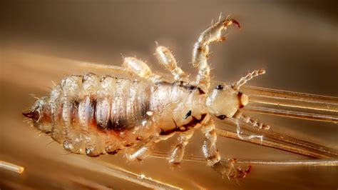 Lice advice: How to kill the pesky, irritating bugs