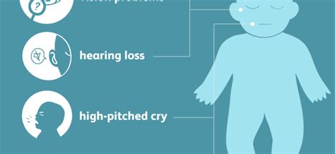 Microcephaly – characteristics, causes and symptoms of microcephaly ...