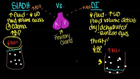 SIADH vs. DI - YouTube