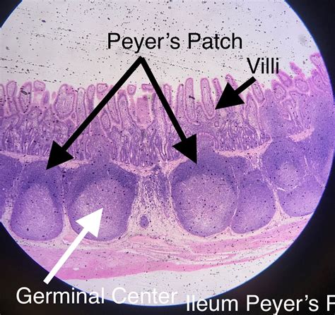 Peyer's Patch Histology.