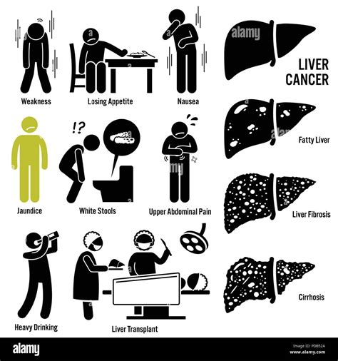 Liver Cancer Symptoms Causes Risk Factors Stick Figure Pictogram Icons ...