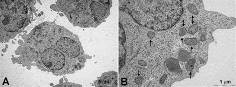 Control K562 cells. (A) The cells show a normal ultrastructure. (B ...