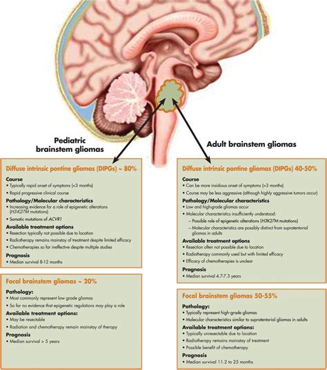 Adult brainstem gliomas - Eisele - 2016 - Cancer - Wiley Online Library