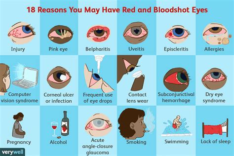 Eye Redness Causes and Treatments