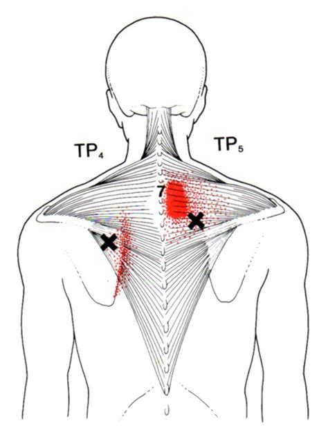 Neck And Chest Muscles Diagram : Muscles of anterolateral chest wall and shoulder | Image ...