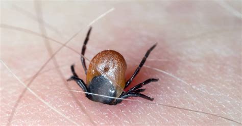 Which Ticks Carry Lyme Disease? - Wiki Point