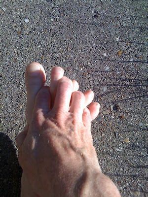 Bunion exercises – Artofit