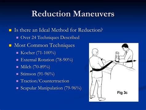 PPT - Management of Acute Shoulder Dislocation PowerPoint Presentation - ID:1184583