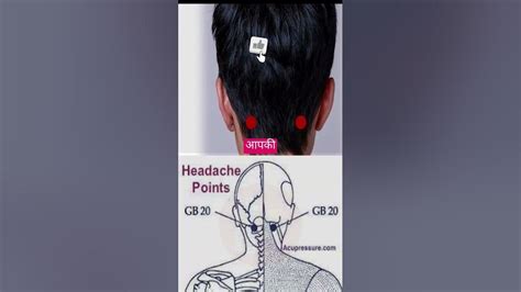 Acupoints GB20 for headache relief #health #acupressure #trending #shorts #bareilly # ...