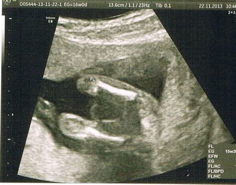 16 week ultrasound - GENDER REVEAL! | BabyCenter