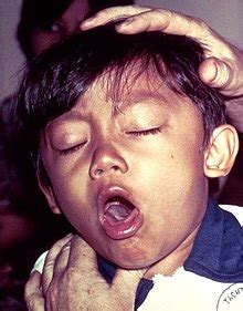 Cough - Wikipedia, the free encyclopedia