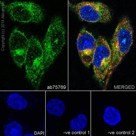 Recombinant Anti-CD146 antibody [EPR3208] KO Tested (ab75769) | Abcam