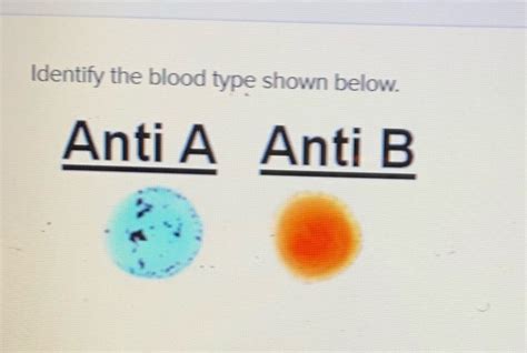 Solved Identify the blood type shown below Anti A Anti B | Chegg.com