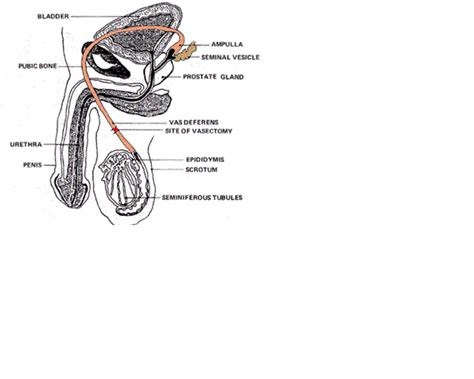 vasectomy side effects: 2014