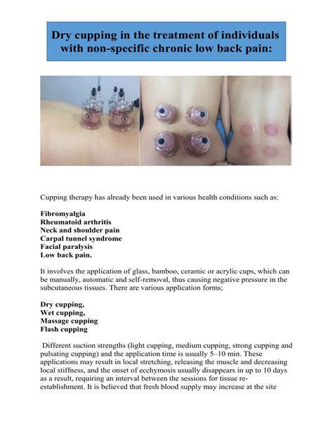 cupping for low back pain[2305843009214683579]