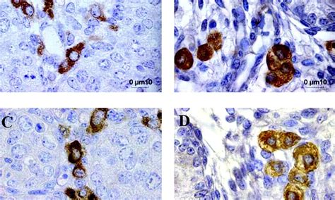 Endogenous estrogens inhibit mouse fetal Leydig cell development via estrogen receptor alpha