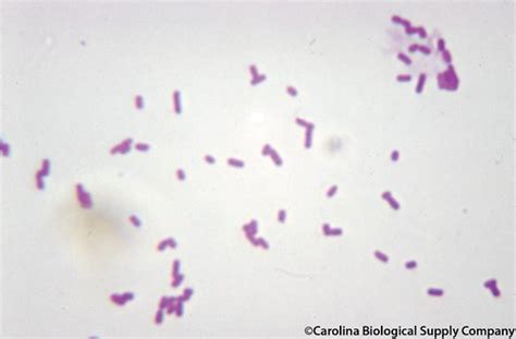 Bacillus Stearothermophilus Gram Stain