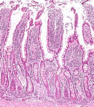 Intestinal villus