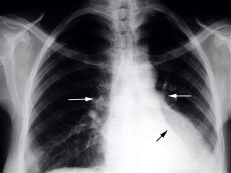 Pulmonology: Diseases And Conditions by Baanie D.