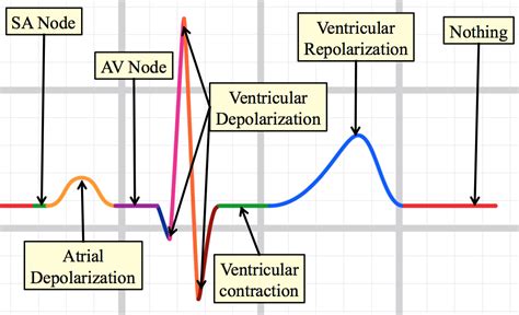 All actions on the ECG