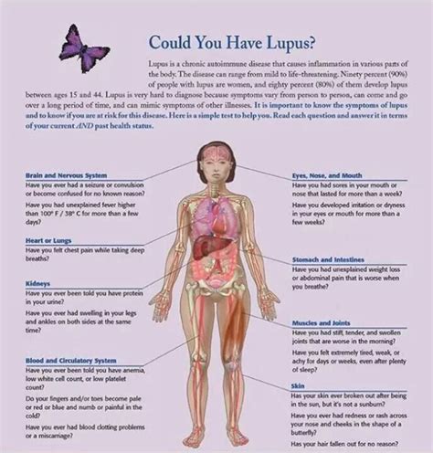 Lupus chart | Lupus facts, Diagnosing lupus, Lupus awareness