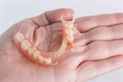 When Is It Time to Get Your Dentures Relined? | Ottawa South Denture Clinic