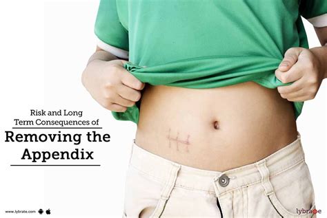 Risk And Long Term Consequences Of Removing The Appendix! - By Dr. S P ...