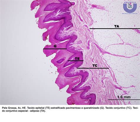 Tecido Epitelial De Revestimento Estratificado Pavimentoso Queratinizado - RETOEDU