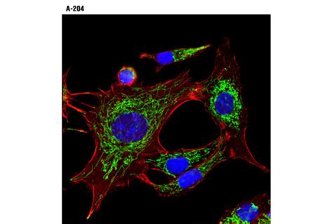 Mitochondrial Marker Antibody Sampler Kit | Cell Signaling Technology