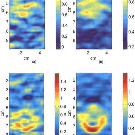 (PDF) Ultrasound Attenuation Imaging Using Compound Acquisition and Processing