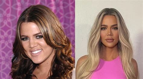 Khloe Kardashian Before & After Photos: Shocking Transformation in 2022 ...