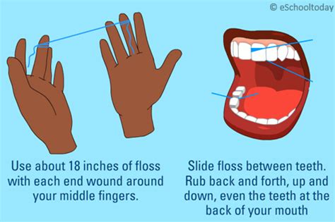 Correct Way To Floss Your Teeth - Teeth Poster