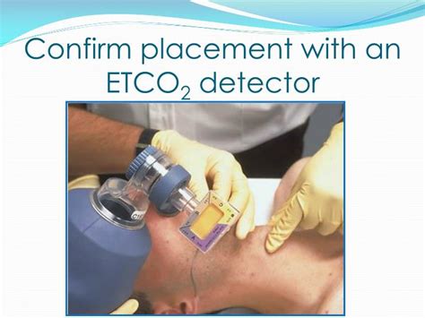 PPT - Orotracheal Intubation PowerPoint Presentation - ID:868329