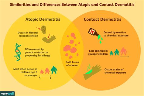 Atopic and Contact Dermatitis: How They Differ