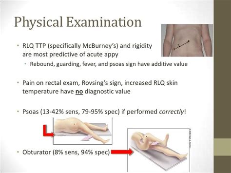 psoas sign obturator sign - Google Search