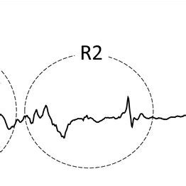 Example of the bulbocavernosus reflex. In the bulbocavernosus reflex,... | Download Scientific ...