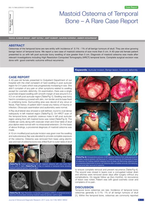 (PDF) Mastoid Osteoma of Temporal Bone - A Rare Case Report