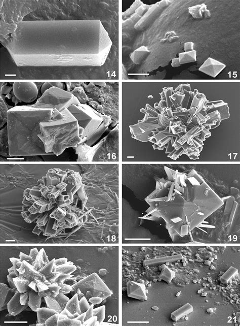 Calcium Oxalate Crystals In Plants