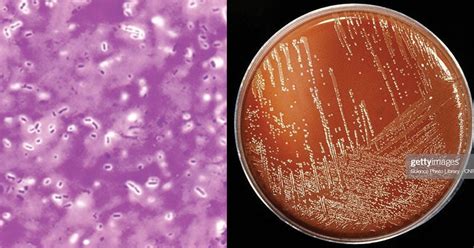 Enterobacter Aerogenes Gram Stain