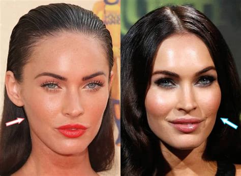 Has Megan Fox Had Cosmetic Surgery?