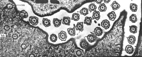 Cilia, flagella, and centrioles | Celebrate Cytochemistry | Gwen V. Childs, Ph.D.