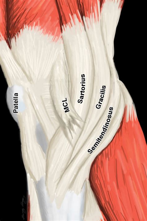 Pes Anserinus: Anatomy and Pathology of Native and Harvested Tendons | AJR