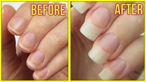 before and after nail growth | How to grow nails, Grow long nails, Make ...