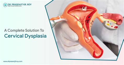 A Complete Solution To Cervical Dysplasia