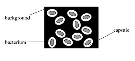 Capsule Stain: Principle, Procedure and Results - Learn Microbiology Online